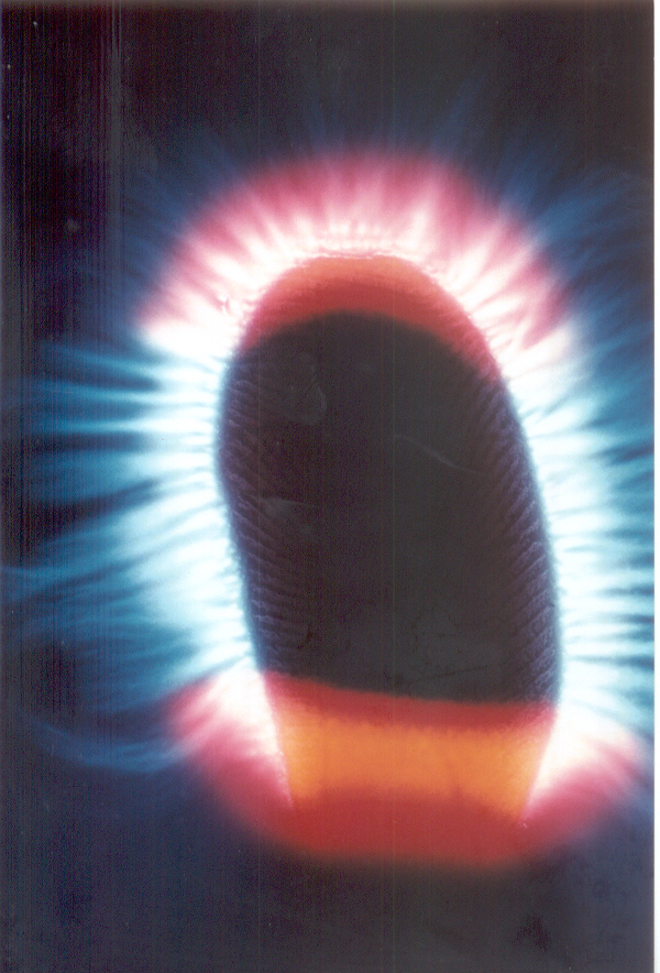 Fotografia bioeletrográfica nº 2 - Indicador Direito
